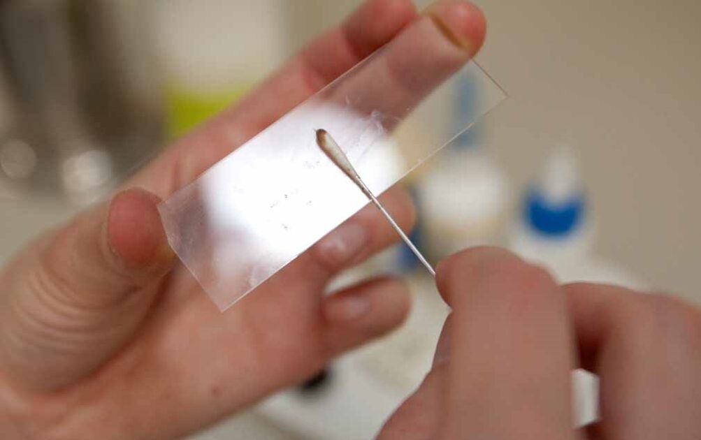 Kratzen auf das Vorhandensein von Parasiten im Körper