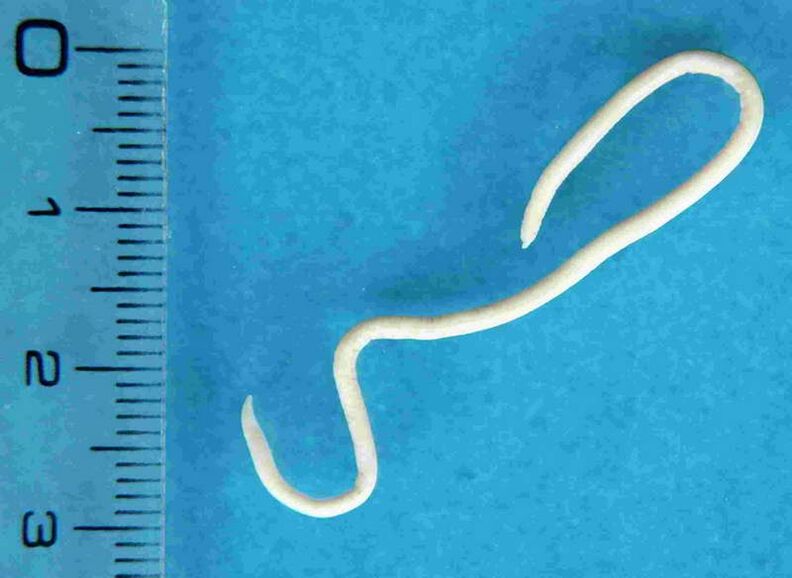 Wurm aus dem menschlichen Körper