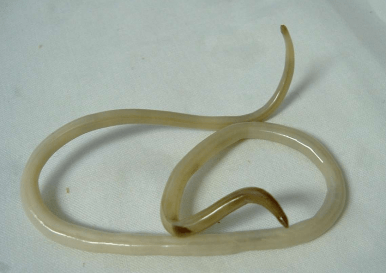 Wurm aus dem menschlichen Körper und seine Behandlung